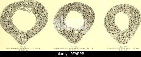. Un contributo per l'istologia comparativo del femore. Femore; osso. . Si prega di notare che queste immagini vengono estratte dalla pagina sottoposta a scansione di immagini che possono essere state migliorate digitalmente per la leggibilità - Colorazione e aspetto di queste illustrazioni potrebbero non perfettamente assomigliano al lavoro originale. Foote, James Stephen, 1851-1925; Hrdlicka, Ales, 1869-1943. Washington, Smithsonian Institution Foto Stock