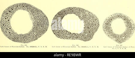 . Un contributo per l'istologia comparativo del femore. Femore; osso. . Si prega di notare che queste immagini vengono estratte dalla pagina sottoposta a scansione di immagini che possono essere state migliorate digitalmente per la leggibilità - Colorazione e aspetto di queste illustrazioni potrebbero non perfettamente assomigliano al lavoro originale. Foote, James Stephen, 1851-1925; Hrdlicka, Ales, 1869-1943. Washington, Smithsonian Institution Foto Stock