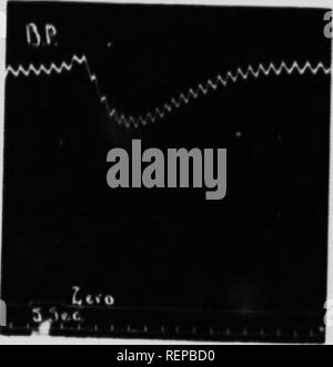 . Modifiche vascolari prodotta da adrenalina nei vertebrati [microformati]. Adrenalina; vertebrati; vasi sanguigni; Adrénaline; Vertébrés; Vaisseaux sanguins. IIARTM.W, KirjU"R AMI ho,Afi ij? I "'ssiiiv ( l&LT;"ui. Io! I v;è nisWy ..htiiill.'.l fn.ill n.hnijilii:. KID 3 teglie Uils IIMljilly |,|C.-.-.L(.<l |,y ;, l,n,.f ,è,.. Sensore di acqua nel combustibile), hwiivv f perde i linea |.p(.ssor cfTccts ha portato. Tlie Althuiijrli Ijiiil) inclusa nel pletliysinojrraph [ussessed un sinjiller itntportion di iinis.-le rispetto a quella nella maggior parte maniinals ha dato la dilatazione attiva (Fig. 4) ex-. Si prega di notare che queste immagini sono extrac Foto Stock