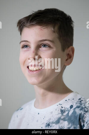Il 15-anno-vecchio Kettley Mason che ha un raro tumore al cervello che subirà leader a livello mondiale per il trattamento alla NHSÕs nuovo fascio di protoni centro terapia al Christie hospital di Manchester. Foto Stock