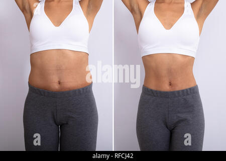 Prima e dopo il concetto che mostra il grasso a Slim Donna Foto Stock