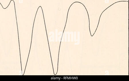 . Carnegie Institution di Washington la pubblicazione. 74 spettri di assorbimento di un certo numero di sali acetato di neodimio. La tabella 15 riporta i risultati ottenuti per le soluzioni di neodimio acetato in acqua. Le concentrazioni, la lettura da sinistra a destra, sono state 0.(517, 0,308, 0,154 e 0,077 normale, rispettivamente, la corrispondente profondità di assorbimento di 100 o m 75 UJ a | 50 UJ Q. 25 0,65/;. Il neodimio acetato profondità cella 2,5 mm. Concentrazione 0.6I7N 0,7 a 0.75/7 0.8/7 Fig. 30. 0.85/7 0.9/7 0.95/7 100 75 o 50 UJ o UJ 0. 25 0,65/z. Si prega di notare che queste immagini vengono estratte dalla pagina sottoposta a scansione di immagini che possono essere Foto Stock