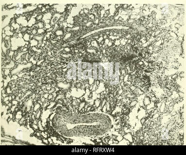 . Il carcinoma della tiroide in salmonoid pesci. Trote; tiroide; cancro gozzo. Kl&LT;;. 84.-Sezione di wild Wisconsin trota di fiume. Fegato grezza feedinn IJ mesi, hocal developnitnl CMrcinoni.i della tiroide. Piccolo gruppo di follicoli con epitelio colonnare. Colloide ridotta. Hypersemia circa i follicoli. A neripherv normale tiroide inalterati i follicoli. X86.. Fig. S5.- -Wild Wisconsin trota di fiume materie cuore alimentazione niouths 12. Carcinoma BegiuniiiK del th. roid. X.Sh.. Si prega di notare che queste immagini vengono estratte dalla pagina sottoposta a scansione di immagini che possono essere state migliorate digitalmente per readab Foto Stock