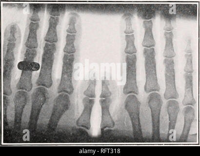 . Carnegie Institution di Washington la pubblicazione. FIG. 45.-11512.1 c? O. R. FIG. 40.-194.2 cf A. K. A.. Si prega di notare che queste immagini vengono estratte dalla pagina sottoposta a scansione di immagini che possono essere state migliorate digitalmente per la leggibilità - Colorazione e aspetto di queste illustrazioni potrebbero non perfettamente assomigliano al lavoro originale. Carnegie Institution di Washington. Washington, Carnegie Institution di Washington Foto Stock