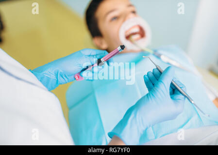 Guarnizione di tenuta del processo di installazione, odontoiatria pediatrica, bambini stomatologia. Dentista femmina funziona con un ragazzo in clinica dentale Foto Stock