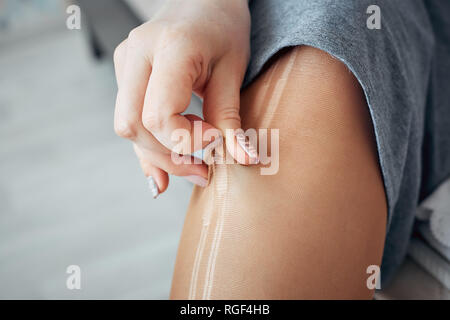 Rip Collant in nylon su una donna è la gamba Foto Stock