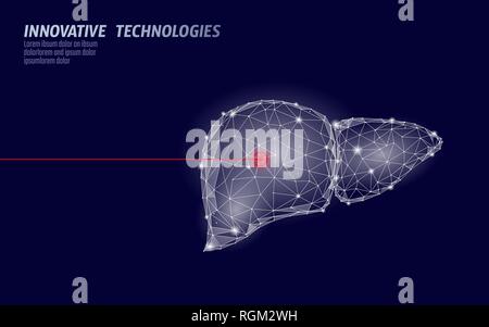 Il fegato umano la chirurgia laser funzionamento bassa poli. Malattia della medicina il trattamento con il farmaco area dolorosa. I triangoli rossi poligonale 3D render forma. Farmacia Illustrazione Vettoriale