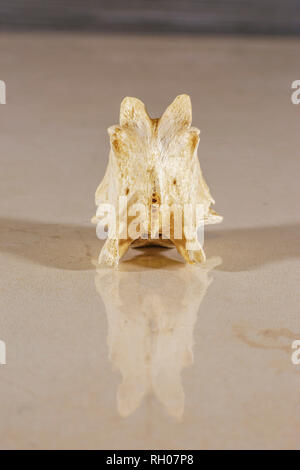 Anatomia delle vertebre che costituisce la colonna vertebrale Foto Stock