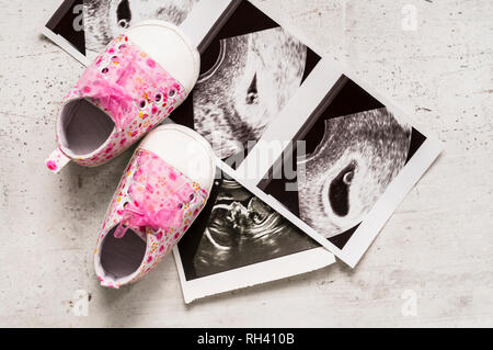 Scarpine rosa accanto alla foto del bambino con ultrasuoni a 4 e 20 settimane di gravidanza. Il concetto di aspettare una bambina, gravidanza. Figlia. S Foto Stock