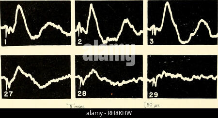 . Meccanismi cerebrali e apprendimento, un simposio. Psicofisiologia; apprendimento, psicologia del. 398 meccanismi cerebrali e apprendimento elettrodi bipolari sono stati impiantati permanentemente nella colonna laterale della parte superiore del torace segmenti del midollo spinale. Al fine di evitare di dis- tirocini del midollo spinale durante i movimenti della colonna vertebrale, la vertebra di essere perforato è saldamente fissato alla vertebre adiacenti per mezzo di una piastra di vanadio. L'elettrodo è stato costituito da due isolati Fili in acciaio inossidabile, le cui punte sono state scoperte e i mm. oltre. Elettrico singolo impulsi quadrati di o.i msec, Foto Stock