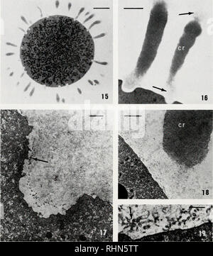 . Il bollettino biologico. Biologia; Zoologia; biologia; biologia marina. 184 Clark, JR., LYNN YUDIN E PERSYN gi. La figura 15. Una micrografia di luce di un oocita durante le fasi iniziali della corticale dissipazione di asta. Bar = 50 /tm. La figura 16. Un ingrandimento superiore mostra le aste corticale dissipando (frecce). Bar - 10 pan. La figura 17. Una micrografia elettronica a trasmissione che illustra la base di una cripta, dis- sociated asta, e numerosi piccoli elementi vescicolare (freccia). Bar = 1 fj.m. La figura 18. Una bella vista strutturale di asta corticale (cr) dissociazione. Ancora una volta, vescicolare ele- menti sono notati lungo il oo Foto Stock