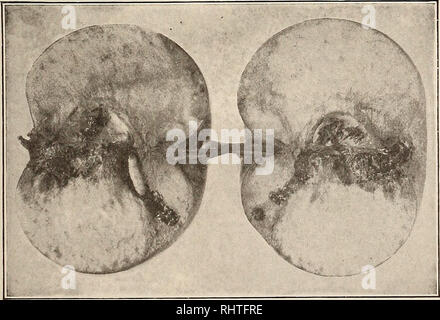 . Frutti migliori. Frutti-coltura. La figura 2 le porzioni di mele, ingrandita di due e mezzo, che mostra "punge" e cicatrici da CURCLTLIO (I'rom Stedman, bollettino 64, Missouri Agricolo Experiment Stazione) vengono visualizzati. Essi sono illustrati su frutta nella Fig. 7. Essi sono un po' più piccole rispetto alla testa di un perno comune, quasi circolare in profilo, leggermente convessa e quando di cui siano bloccati saldamente sulla superficie. Senza un esame più ravvicinato e sono simili a minute gocce di latte o macchie di spray. Esso richiede molto vicino cerca di scoprire il loro, anche se talvolta è possibile, ruotando th Foto Stock