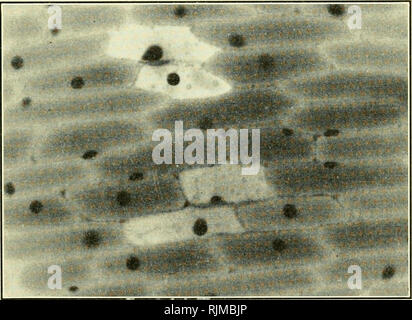 . Gli aspetti fondamentali degli effetti delle radiazioni su sistemi viventi. Radiazione -- effetto fisiologico. Fig. 1. Preparazione di controllo. C'è piuttosto uniforme per la memorizzazione di arancio di acridina nel vacuolo cellulare con fluorescenza di varie sfumature di giallo-arancione. Il citoplasma lungo le pareti cellulari genera fluorescenza verde; i nuclei sono verde giallognolo.. Fig. 2. La sezione è stata iiiadiated per 4 min. due "spot" aree hanno una intensa concentrazione di colorante (mattone-fluorescenza rossa). Questo ha migrato da celle adiacenti al danneggiato nel citoplasma. Le cellule rimanenti hanno l'aspetto del controllo, tranne f Foto Stock