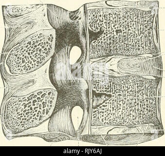 . Un atlante di anatomia umana per gli studenti e per i medici. Anatomia. 174 LE ARTICOLAZIONI DEL TRONCO Ligamenta sruonaviK Ligg. flava , Corpo della dodicesima vertebra dorsale | Corpu . Le vertebre thoracalis XII. Interspinous ligamen' Lig. interspinale processo spinoso della dodicesima vertebra dorsale legamento Supraspinous: Lig. supraspinale epifisi dell'apofisi pro- cesso della prima vertebra lombare. Comune di processi articolari / Articulatio intervertebralis forame intervertebrale Foramen intervertebrals strato di cartilagine ialina Stratum cartilagineum "epifesi del corpo vertebrale A Foto Stock