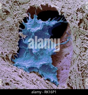Osteocyte cellule ossee, SEM Foto Stock
