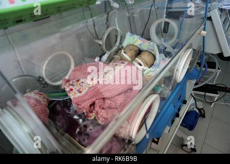 Sanaa, Yemen. Il 9 febbraio, 2019. Neonato gemelli siamesi giacciono in un incubatore a al-Thawra ospedale in Sanaa, Yemen, nel febbraio 9, 2019. Il neonato gemelli siamesi intrappolati nell'yemenita dai ribelli capitale Sanaa morì sabato mentre si è in attesa di essere trasferiti all'estero per chirurgia salvavita, yemeniti le autorità sanitarie ha detto in una dichiarazione. Credito: Mohamed al-Azaki/Xinhua/Alamy Live News Foto Stock