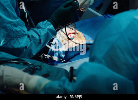 Neurochirurgia eseguire chirurgia per le accise un tumore cerebrale Foto Stock