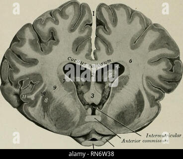. L'anatomia di animali domestici. Anatomia Veterinaria. 790 DEL SISTEMA NERVOSO DEL CAVALLO laterales).! La superficie ventrale ha la configurazione inversa, e presenta trans- versetto creste e gole. Essa forma il tetto dei ventricoli laterali e il setto pellucidum è attaccato ad esso medialmente. Le fibre del corpo calloso (con l'eccezione della stria longitudinale;) scorrono trasversalmente e diffondersi lateralmente in tutte le direzioni in tlie bianca centrale questione di emisferi al cor- tex, formando la radiazione del corpus callostun (Radiatio corporis callosi). Il fornice è un bi Foto Stock