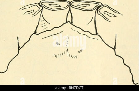 . Anatomischer Anzeiger. Anatomia, comparativo, Anatomia, comparativo. 437 Sf ^ ^ Fig. 1. 4 jähr. Wallach. paar werden durch die naturgetreuen Skizzen veranschaulicht, welche ich von 24 abgenommen Fällen habe. Aus ihrer Keihe wählte ich 8 Typen zur dimostrazione Mündungen der. Von den übrigen wären zwei Fälle erwähnenswert, die sich weniger zur bildlichen Darstellung eigneten. Beide essere- treffen hochaltrige Tiere (über 20 Jahre). Das eine zeigte nur schatten- hafte, minimale, bogige Bildungen, dicht hinter I^ (keine eigent- lichen Spalten!). Das andere, dessen Schleimhaut - chronisch ent- zündlic Foto Stock