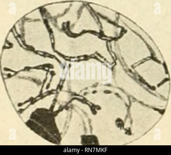 . Anatomischer Anzeiger. Anatomia, comparativo, Anatomia, comparativo. 378 Eine Zählung der dichtgedrängten und vielfach gebogenen Chro- matinfäden natürlich ist außerordentlich schwierig und nur in einem einzigen caduta (Fig. 9) ist sie mir überhaupt gelungen; hier konnte ich aber mit Sicherheit 17 Chroraatinfäden von verschiedener Länge kon- statieren. Dies mag wohl ein Zufall sein und jedenfalls wäre auf diese Zahl nach einer einzigen Zählung kein großes Gewicht zu legen. Doch erwähne ich es hier, weil diese Zahl eben die Hälfte der 34 Chromosomen der Oogonien repräsentiert und wenn sie als Foto Stock