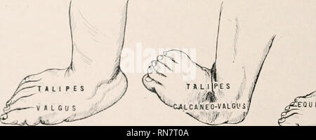 . Anatomia in poche parole : un trattato di anatomia umana nella sua relazione di osteopatia. Anatomia umana; medicina osteopatica; medicina osteopatica; Anatomia. . Si prega di notare che queste immagini vengono estratte dalla pagina sottoposta a scansione di immagini che possono essere state migliorate digitalmente per la leggibilità - Colorazione e aspetto di queste illustrazioni potrebbero non perfettamente assomigliano al lavoro originale. Laughlin, William Ross. Kirksville, Missouri : William Ross Laughlin Foto Stock