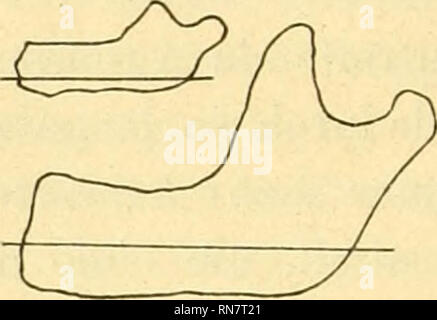 . Anatomischer Anzeiger. Anatomia, comparativo, Anatomia, comparativo. 508 Man stellt sich das Höhenwachstum des Kiefers in der Weise vor, dass vom Neugeborenen zum Erwachsenen der Alveolarteil in der Richtung des Pfeiles un, der Basalteil in der Richtung des Pfeiles h sich erhöhe. Diese Wachstumsweise ist nicht zutreffend. Der Canalis mandibularis ist keine feststehende AVachstumsgrenze. Beim Durch- bruch des Milchgebisses treten zwar die Zahnkronen um ein Geringes aus dem Alveolarteil hervor, das Hauptmoment aber beim Freiwerden der Zahnkronen ist in riassorbimento freien Am Rande des Alveolarteils Foto Stock