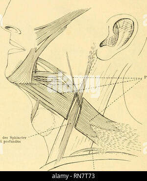 . Anatomischer Anzeiger. Anatomia, comparativo, Anatomia, comparativo. 484 Im Bereiche der sehnigen Ursprungsplatte des Platysma nimmt ein zarter supraclavicularer Muskel seine Entstehung. In leichtem, nach oben konvexen Bogen zieht er medianwärts und endigt unmittel- bar über der clavicola. Dieses rudimentäre Gebilde muß sich von dem bis einstmals zur Schultergegend ausgedehnten Platysma abge- spalten haben. Mit der sehnigen Rückbildung der Platysmaplatte ist. -- Platysma Überrest des Sfintere di colli profundus Supraclaviculares Mnskelbündel. Abb. 3. Leiche Nr. 18/14. Linksseitiger Befund. Im Pl Foto Stock