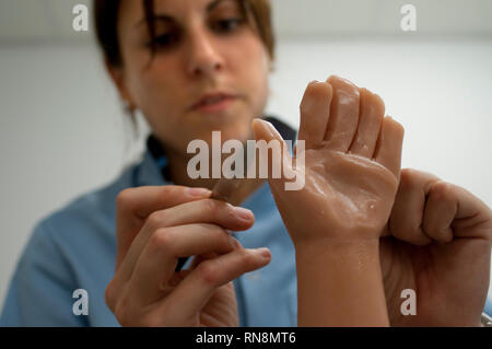 Circa 4.500 bambini spagnoli di protesi di usura perché essi sono nati senza un arto, o perché hanno subito una traumatica amputazione, o a causa di Foto Stock