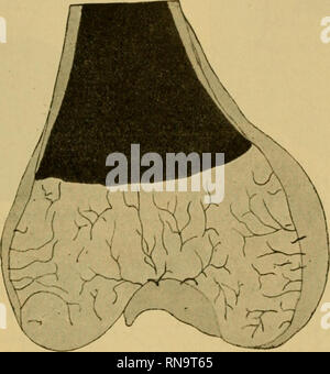. Anatomische Hefte. Beitrag zur Kenntnis Der Architektur spongiüser Knochen. 247 Il suo den Knorpel betritt, Die Gefässe 1. Ordnung geben Äste nach allen Seiten ab, gelenkwärts sowohl als besonders nach abwärts und in der Horizontalebene, welch letztere vielfach der Knorpeloberfiäche verlaufen parallelo. Entsprechend der fast durchwegs konvexen Seitenfläche des knorpeligen Tibiaknaufes zeigen die Hauptstämnie einen centralwärts konvergierenden. Fig. 10. Feruur (ca. 40 cm). Frontalschnitt durch die Kondylen. Verlauf und nur die in die leicht konkave Rückseite der Tibia eindringenden Gefässe diverg Foto Stock