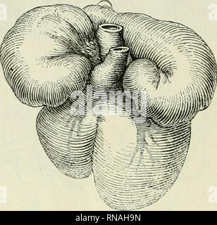 . Il record di anatomica. Anatomia; Anatomia. 172 FRANKLIN P. MALL rect a parlare di sviluppo verso il basso al vertice di lo sviluppo verso l'alto del setto interventricolare, per questo setto appare molto presto, mentre il cuore è ancora nella fase di anfibio, come una leggera cresta del tessuto dentro il cuore di fronte alla inter- ventricolare di scanalatura. Questo segna anche la posizione di inter- forame ventricolare. Come il cuore cresce più grande per un tempo il foramen diventa anche maggiore mentre gli apici crescono verso il basso con una fessura tra loro. Questo è anche il parere. Fig. 13 bifido cuore da Foto Stock