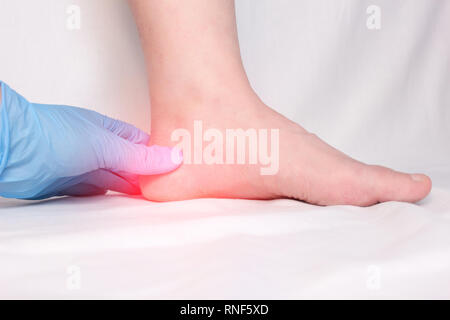 Un medico in guanti medicali esamina un tallone del paziente sperone, dolore al piede e tallone, ortopedico Foto Stock