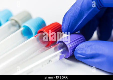Mano indossando guanti blu holding di bottiglie per campioni usati negli ospedali o in medicina per i campioni di sangue in un laboratorio su sfondo bianco Foto Stock