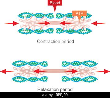 La contrazione muscolare come risultato di impulsi nervosi impostato su off una reazione biochimica che provoca nella miosina di stick di actina. Il corpo umano ed infografico. Illustrazione Vettoriale