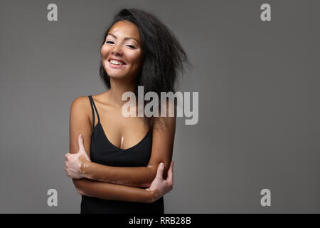 Bella ragazza africana in studio con i problemi della pelle vitiligine. studio di ripresa. Sullo sfondo grigio scuro Foto Stock