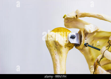 Omero articolato clavicola e scapola ossa umane che mostra la spalla destra comune di anatomia in sfondo bianco Foto Stock