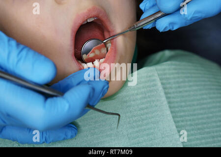Bambina in esame presso il dentista. Ha aperto la sua bocca larga. Dentista esamina i denti di latte. Close-up Foto Stock