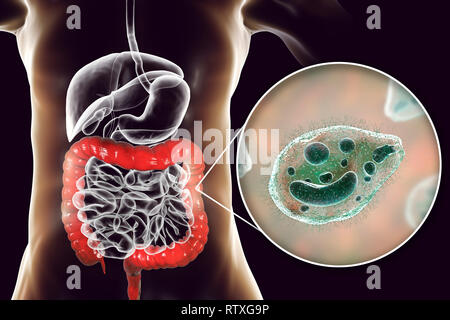 Balantidiasis, immagine concettuale. Computer illustrazione che mostra la vista ravvicinata del protozoo ciliato Balantidium coli, un parassita intestinale il causati Foto Stock