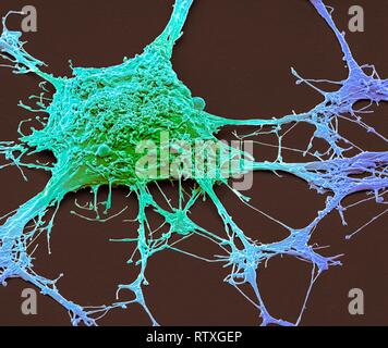 Neurone. Micrografia al microscopio elettronico a scansione (SEM) di un PC12 neurone nella cultura.La linea cellulare PC12, sviluppato da un feocromocitoma tumore del ratto adrena Foto Stock