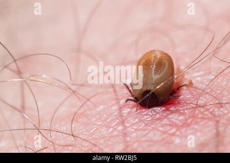 La spunta su pelle umana: un segno di spunta mentre succhiare il sangue da un essere umano Foto Stock