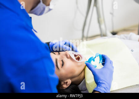 Close-up verticale di un paziente di sesso femminile la visita dal dentista per lo sbiancamento dei denti in clinica Foto Stock