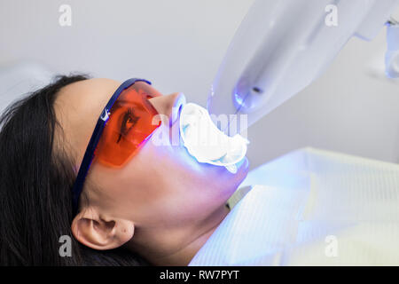 Lo sbiancamento dei denti luce ultravioleta. La ragazza alla reception presso il dentista per lo sbiancamento dei denti. Il concetto di cura dentale. Foto Stock