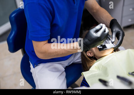 Uomo al dentista clinica riceve il trattamento dentale per riempire una cavità di un dente. Restauro dentale e materiale composito trattare di polimerizzazione di denti. Foto Stock