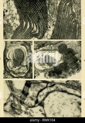 Elettron-struttura microscopica di protozoi (1963) di elettroni struttura microscopica di protozoi electronmicrosco00pite Anno: 1963 Plate II Foto Stock