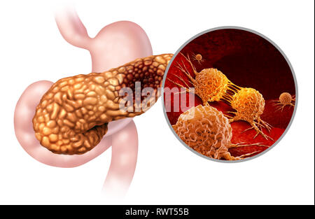 Cancro al pancreas concetto di anatomia e pancreas tumore maligno simbolo come una ghiandola digestiva parte del corpo con un ingrandimento al microscopio. Foto Stock