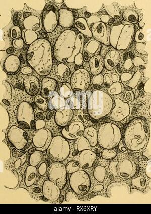 Gli effetti di inanition e gli effetti di inanition e la malnutrizione al momento della crescita e struttura effectsofinaniti00jack Anno: 1925 Fig. 47.-il normale tessuto adiposo, con grandi, poliedrica, le cellule di grasso, dalla tela subcutanea di un neonato. X400. (Parrot '77). Fig. 48.-tessuto adiposo dalla tela sub- cutanea di un emaciato, athreptic neonato. Cellule adipose inegualmente atrophied; alcune contengono ancora una quantità moderata di grassi in goccioline di dimensione variabile. I nuclei cellulari e citoplasma granulare evidente. X400. (Parrot '77). Foto Stock