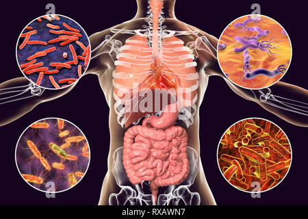 I batteri che causano infezioni umane, illustrazione Foto Stock