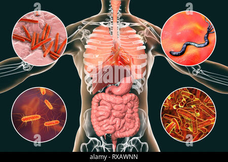 I batteri che causano infezioni umane, illustrazione Foto Stock