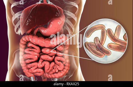 Infezione di colera, illustrazione Foto Stock