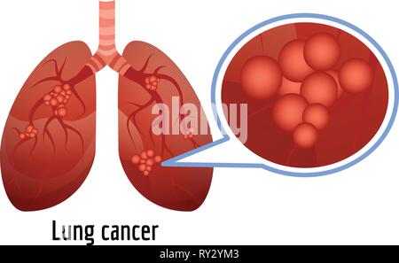 Il cancro del polmone e la relativa icona. Cartoon di cancro al polmone icona vettoriali per il web design isolato su sfondo bianco Illustrazione Vettoriale