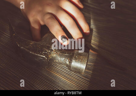 Ferito alla mano con annerita e ammaccati anteprima da bashing è poggiato su di un martello in una vista ravvicinata in una immagine concettuale di lesioni DIY Foto Stock